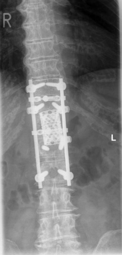 Slide 35